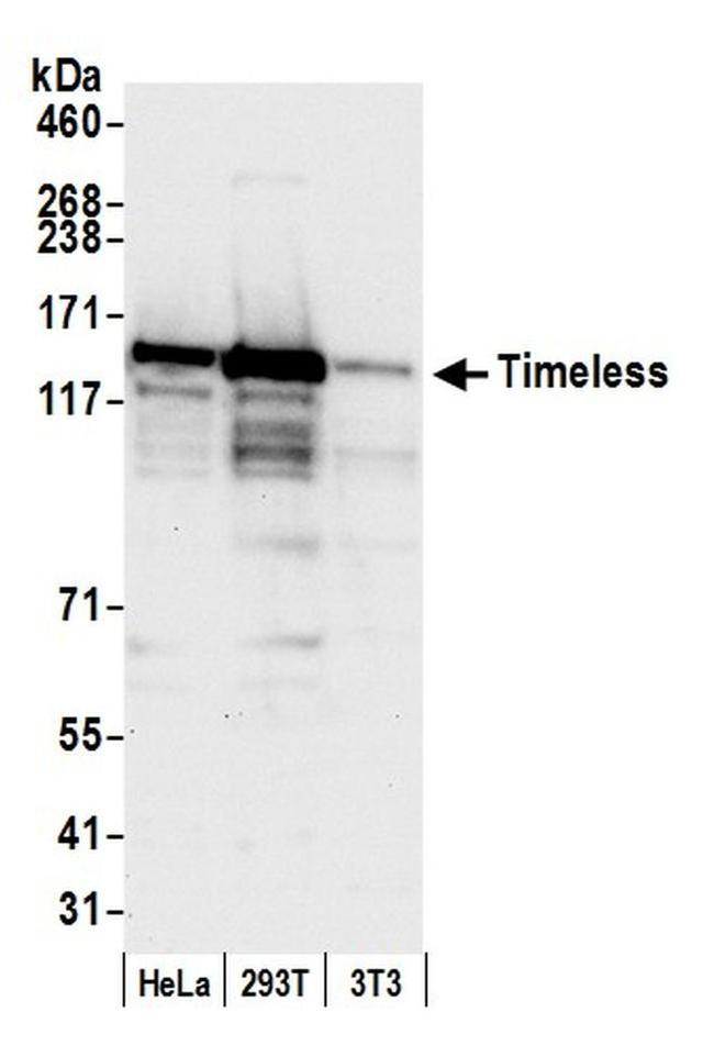 Timeless Antibody in Western Blot (WB)