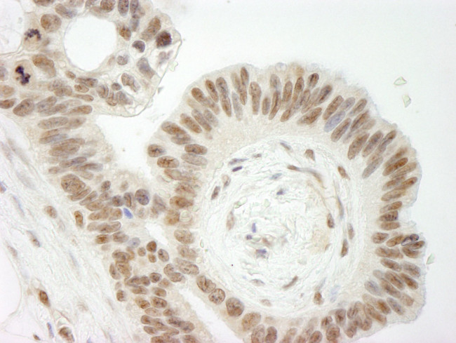 Topo II Beta Antibody in Immunohistochemistry (IHC)