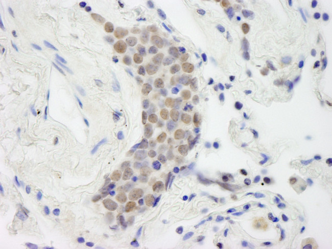 Topo II Beta Antibody in Immunohistochemistry (IHC)