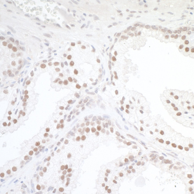 TORC1 Antibody in Immunohistochemistry (IHC)