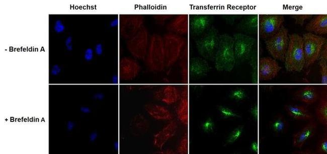 Transferrin Receptor Antibody