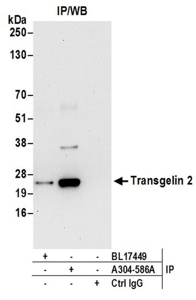 Transgelin 2 Antibody in Western Blot (WB)