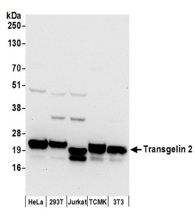 Transgelin 2 Antibody in Western Blot (WB)