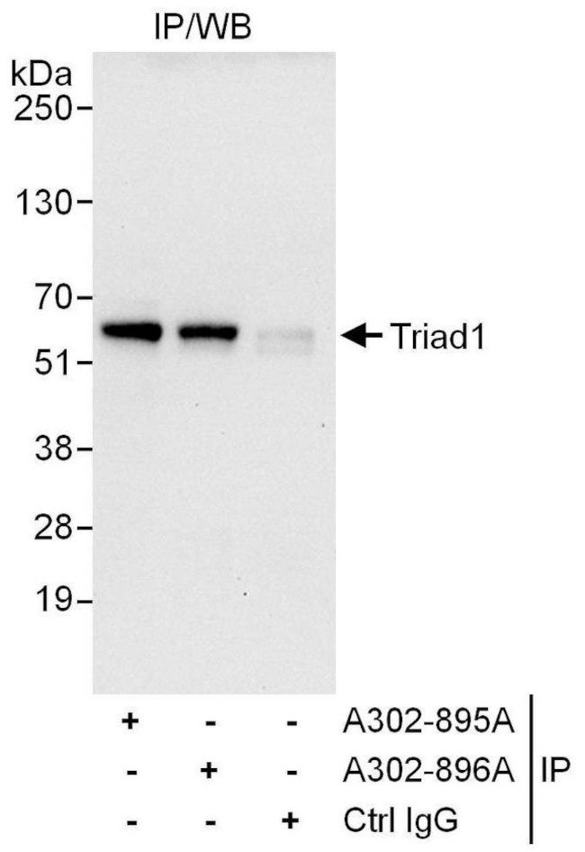 Triad1 Antibody in Immunoprecipitation (IP)