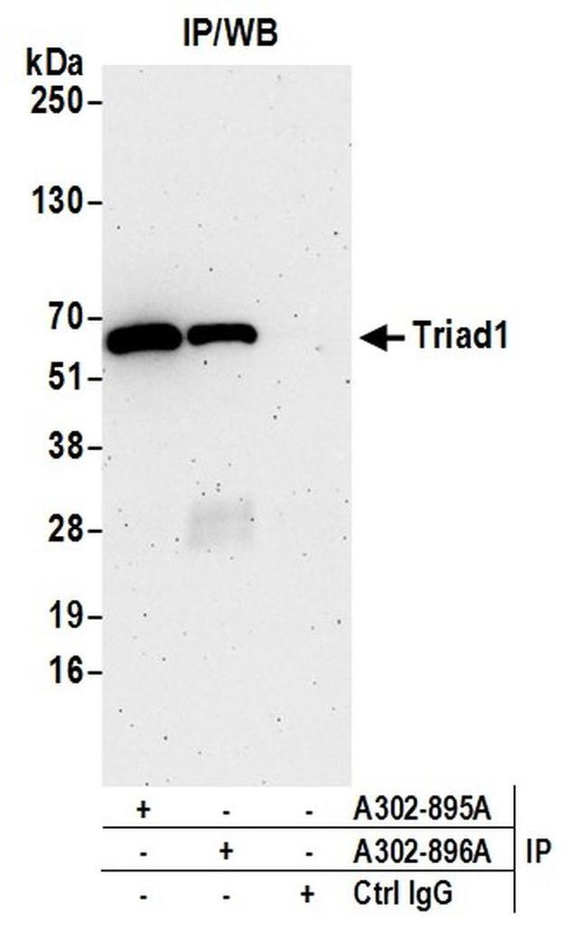 Triad1 Antibody in Western Blot (WB)