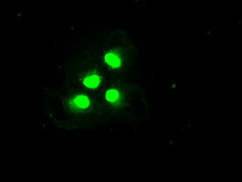 Trim33 Antibody in Immunocytochemistry (ICC/IF)