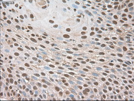 Trim33 Antibody in Immunohistochemistry (Paraffin) (IHC (P))