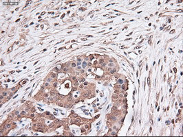 Trim33 Antibody in Immunohistochemistry (Paraffin) (IHC (P))