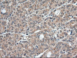 Trim33 Antibody in Immunohistochemistry (Paraffin) (IHC (P))