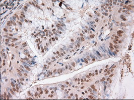 Trim33 Antibody in Immunohistochemistry (Paraffin) (IHC (P))