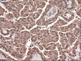 Trim33 Antibody in Immunohistochemistry (Paraffin) (IHC (P))