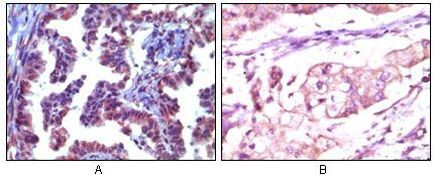 TRIM5 alpha Antibody in Immunohistochemistry (Paraffin) (IHC (P))