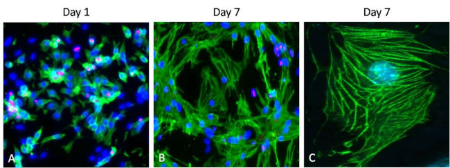 Cardiac Troponin T Antibody in Immunocytochemistry (ICC/IF)