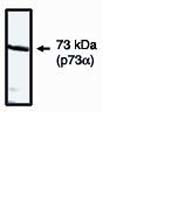 p73 Antibody in Western Blot (WB)