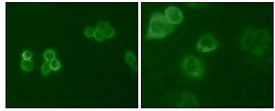 TYRO3 Antibody in Immunocytochemistry (ICC/IF)