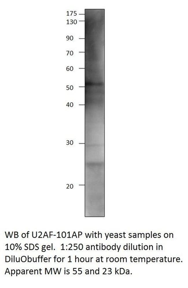 U2AF59 Antibody in Western Blot (WB)