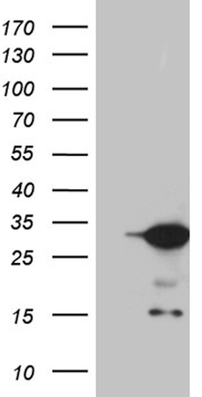 U2AF1L4 Antibody in Western Blot (WB)