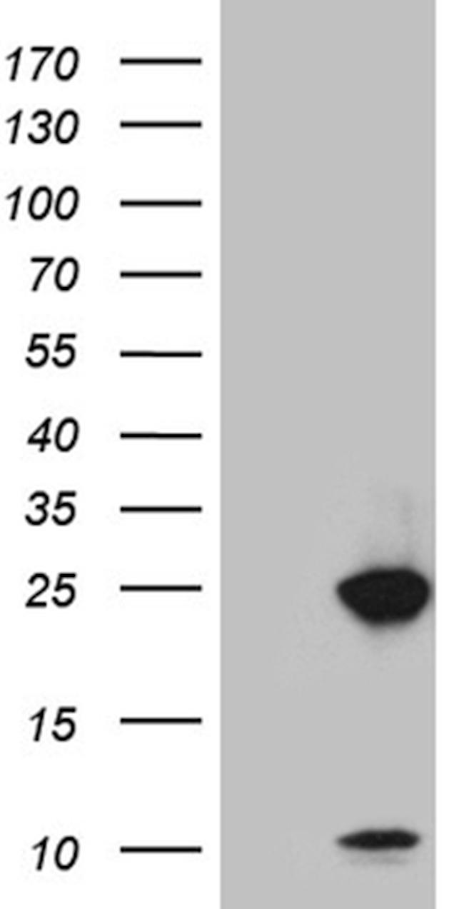 U2AF1L4 Antibody in Western Blot (WB)