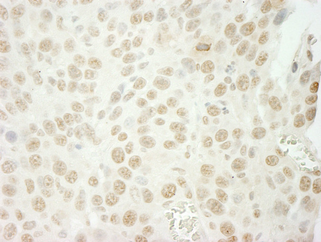 U2AF35 Antibody in Immunohistochemistry (IHC)