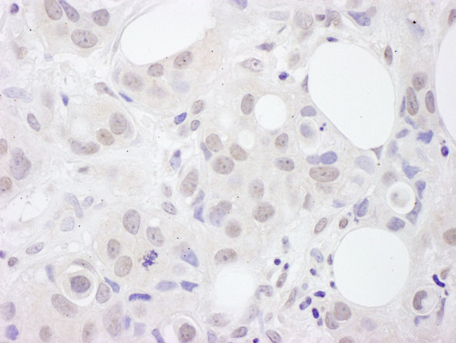 U2AF65 Antibody in Immunohistochemistry (IHC)