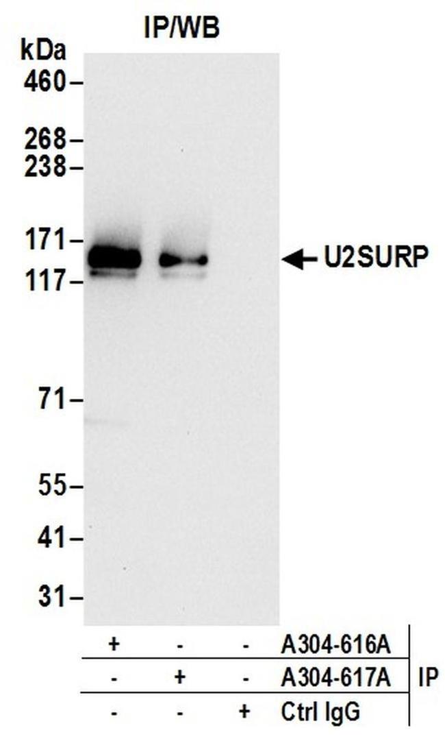 U2SURP Antibody in Western Blot (WB)