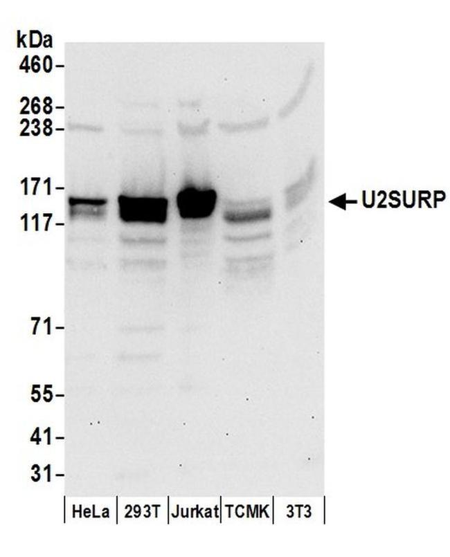 U2SURP Antibody in Western Blot (WB)