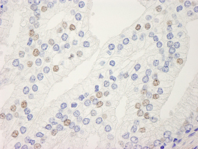 UACA Antibody in Immunohistochemistry (IHC)