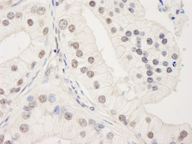 UACA Antibody in Immunohistochemistry (IHC)