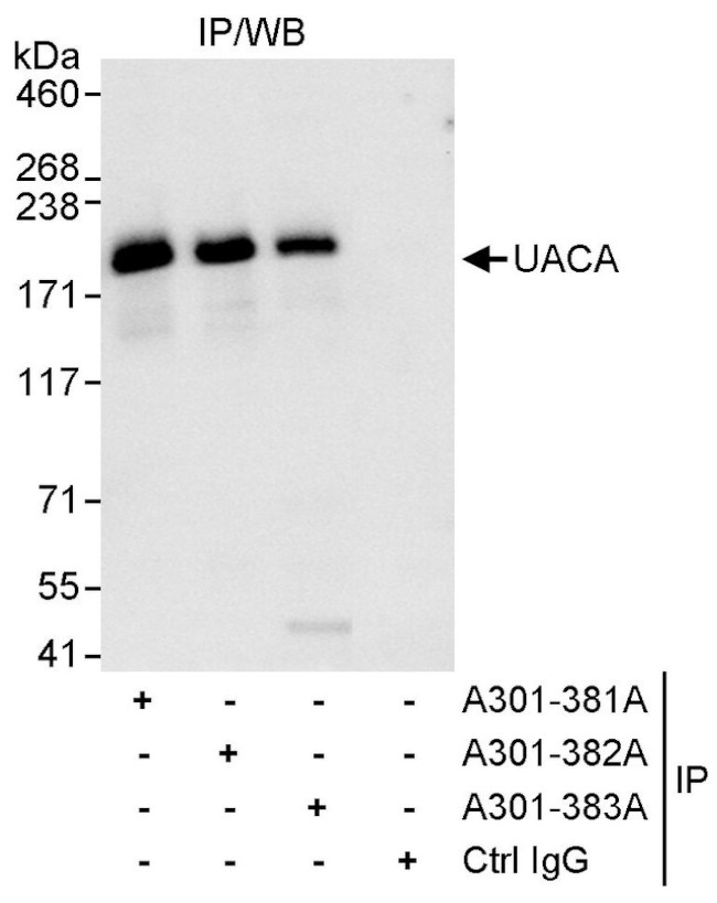 UACA Antibody in Immunoprecipitation (IP)