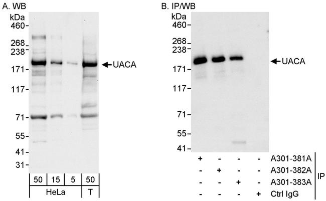 UACA Antibody in Western Blot (WB)