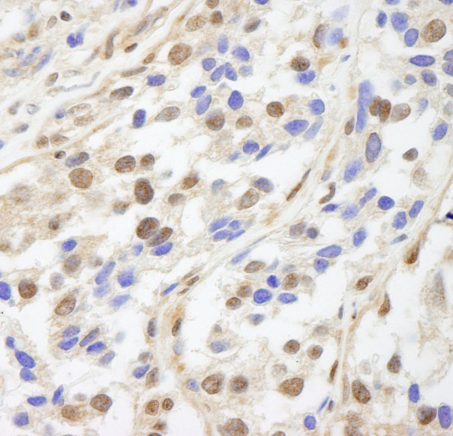 UACA Antibody in Immunohistochemistry (IHC)