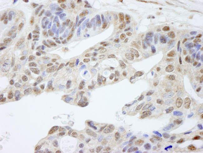 UACA Antibody in Immunohistochemistry (IHC)