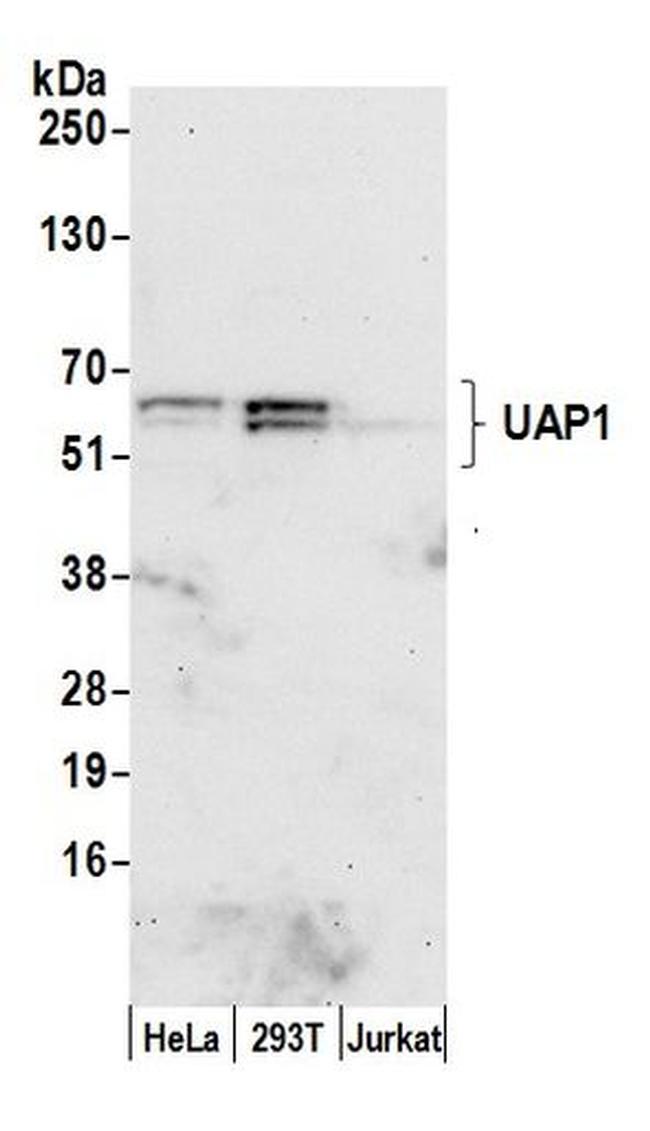 UAP1 Antibody in Western Blot (WB)