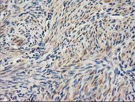 UBA2 Antibody in Immunohistochemistry (Paraffin) (IHC (P))