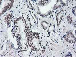 UBA2 Antibody in Immunohistochemistry (Paraffin) (IHC (P))