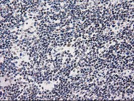 UBA2 Antibody in Immunohistochemistry (Paraffin) (IHC (P))