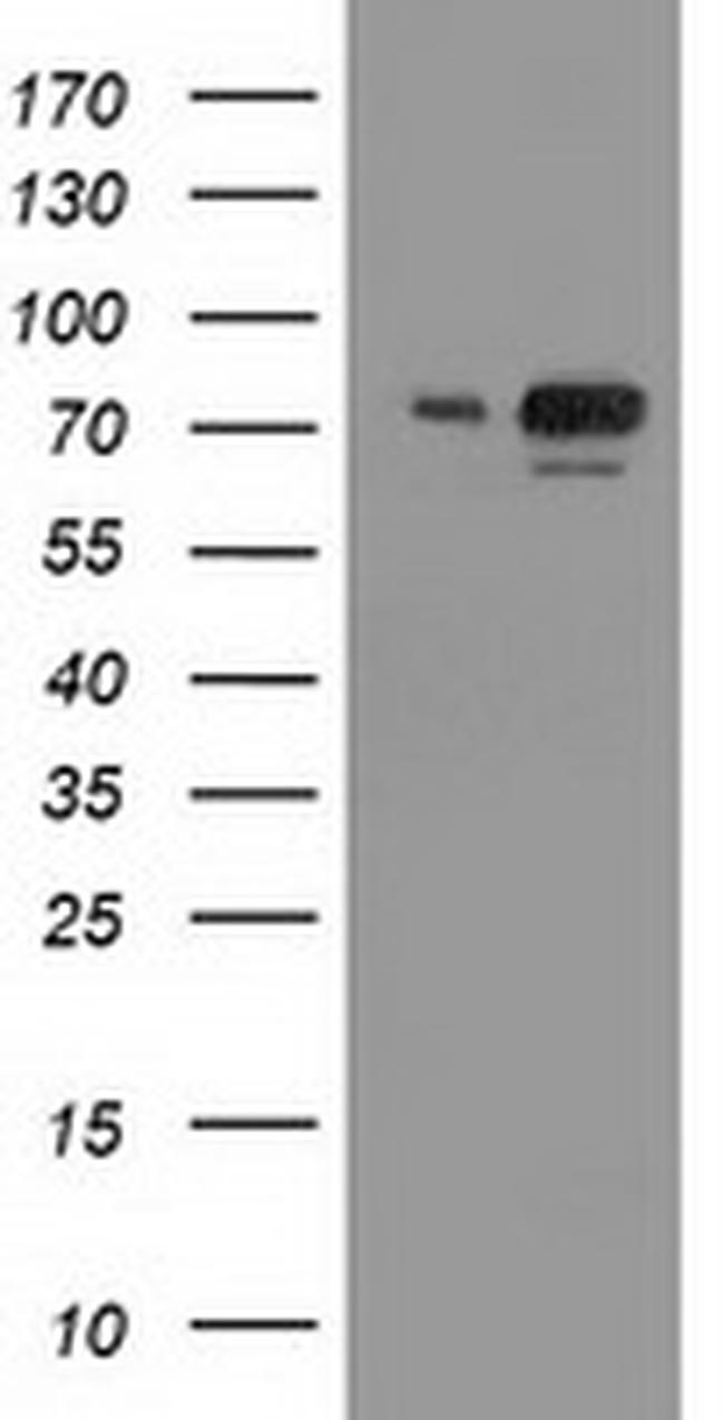 UBA2 Antibody in Western Blot (WB)