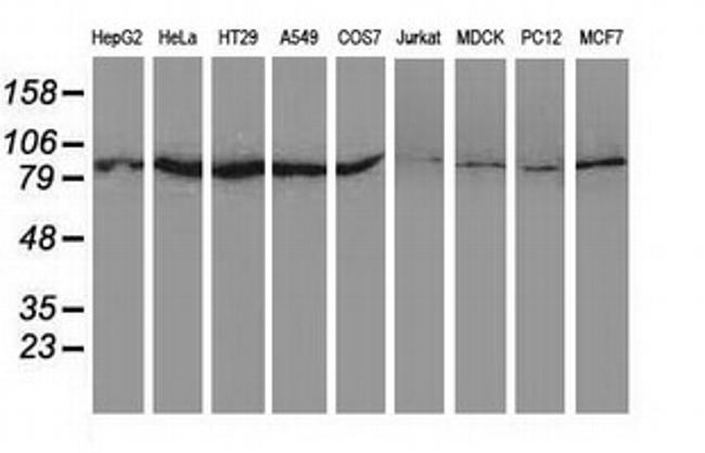 UBA2 Antibody in Western Blot (WB)