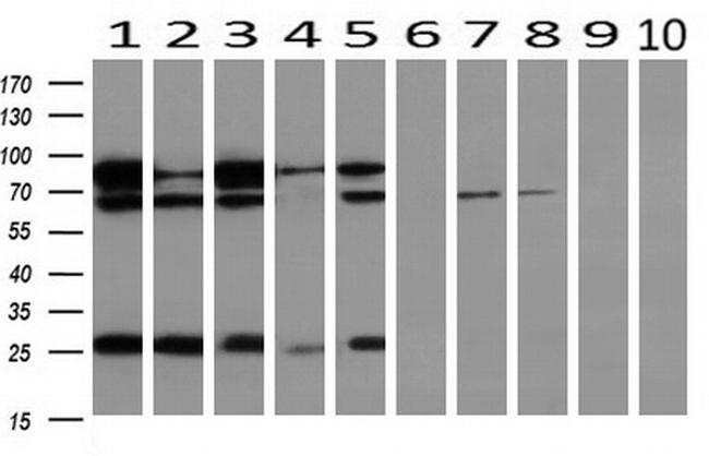 UBA2 Antibody in Western Blot (WB)