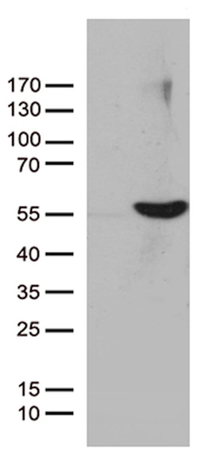 UBA3 Antibody in Western Blot (WB)