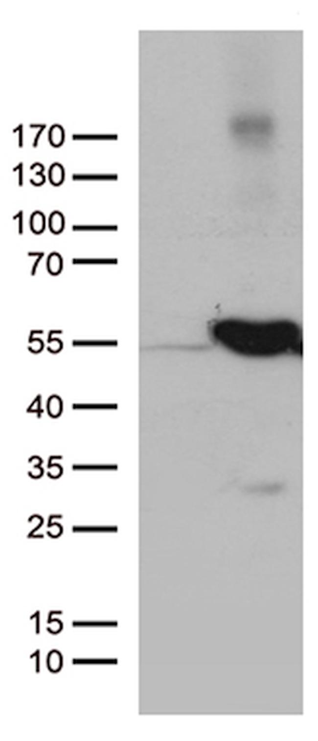 UBA3 Antibody in Western Blot (WB)