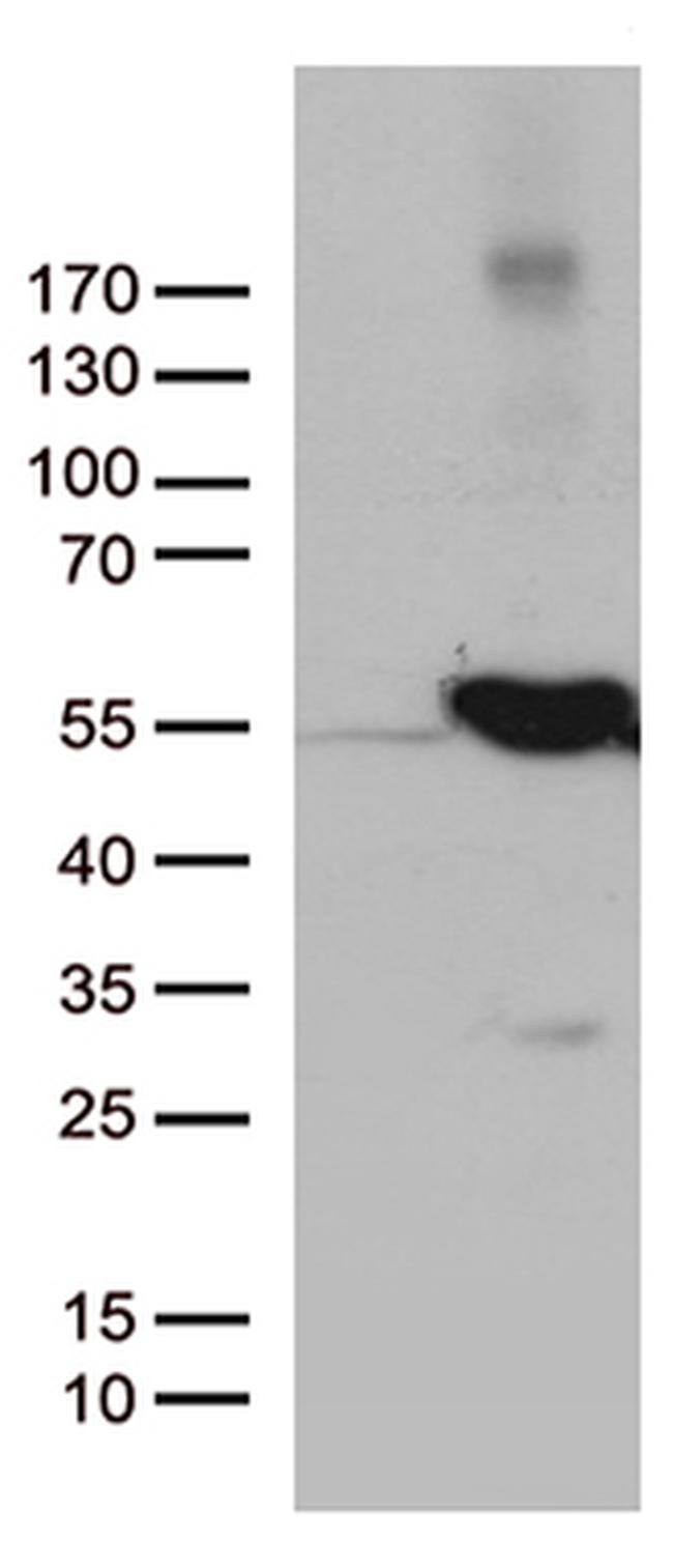 UBA3 Antibody in Western Blot (WB)