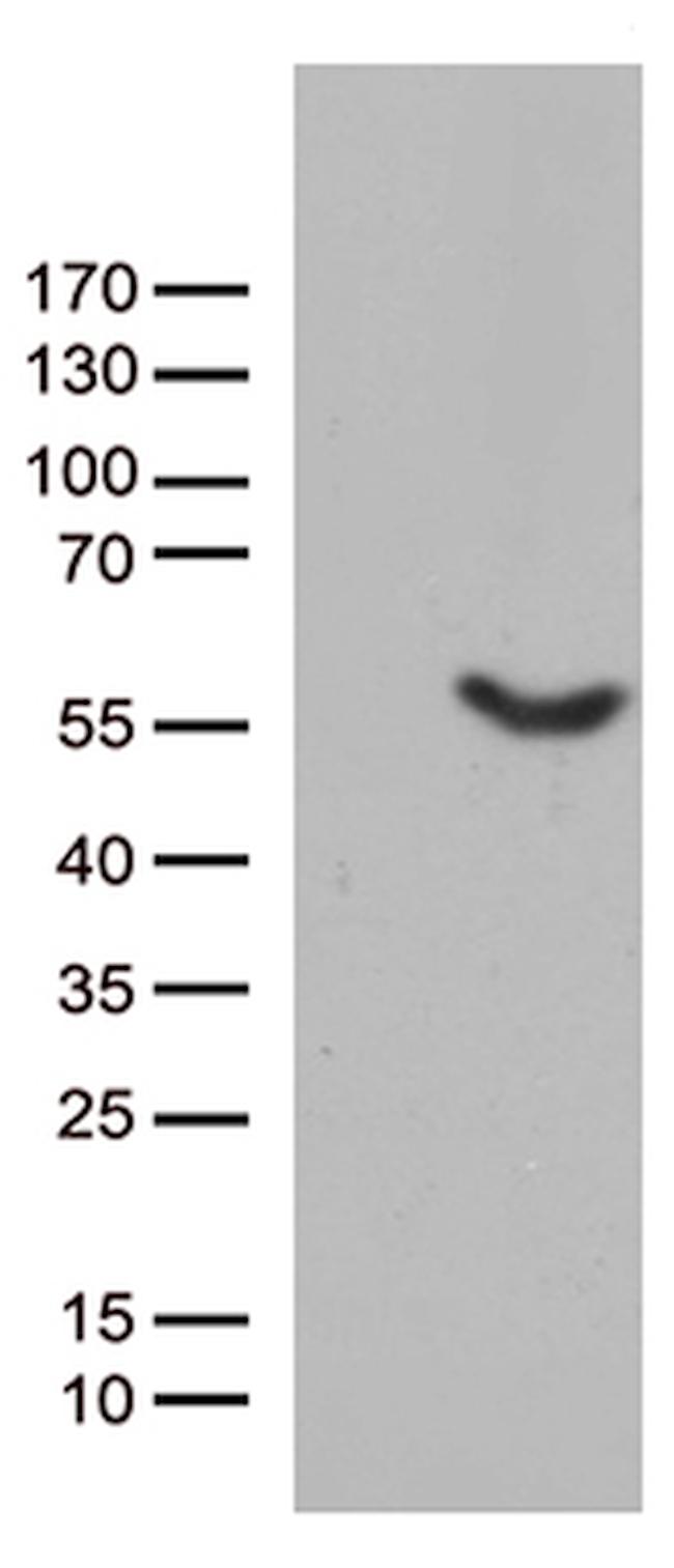 UBA3 Antibody in Western Blot (WB)