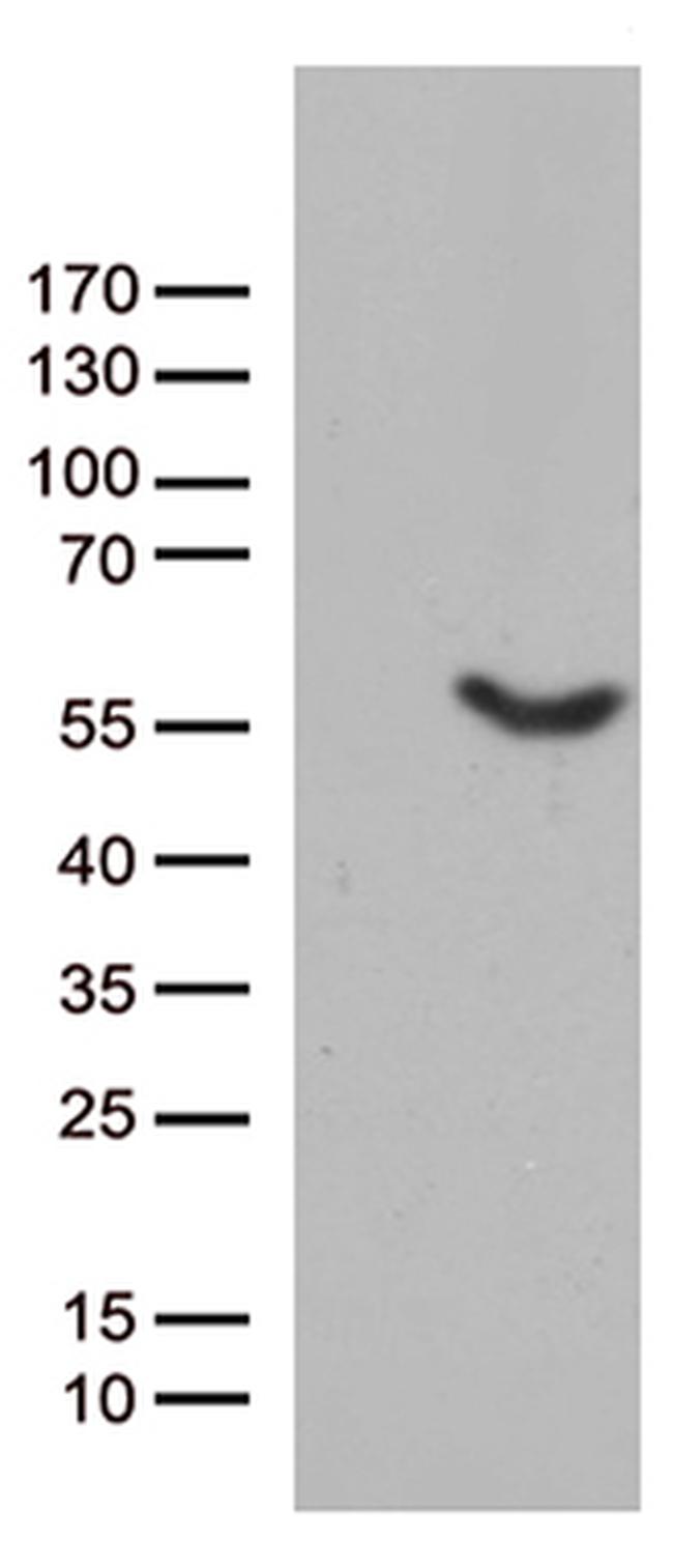 UBA3 Antibody in Western Blot (WB)