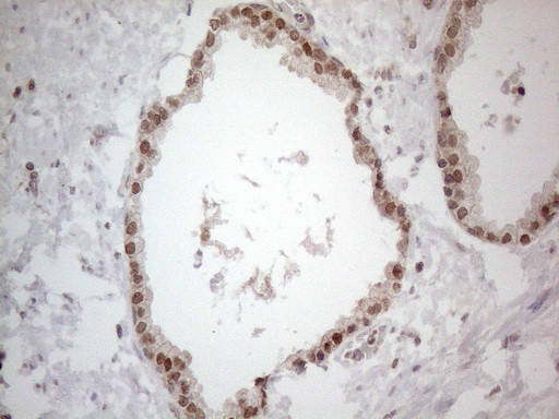 UBA52 Antibody in Immunohistochemistry (Paraffin) (IHC (P))