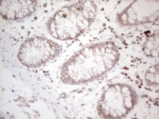 UBA52 Antibody in Immunohistochemistry (Paraffin) (IHC (P))