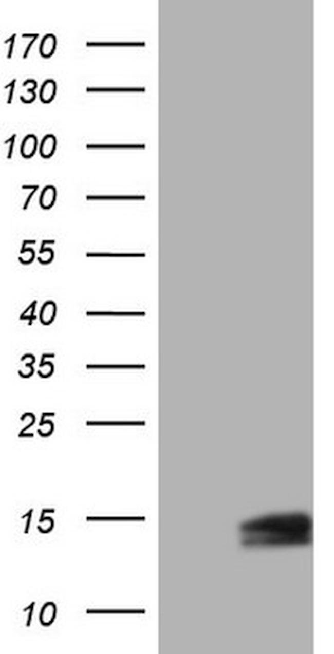 UBA52 Antibody in Western Blot (WB)