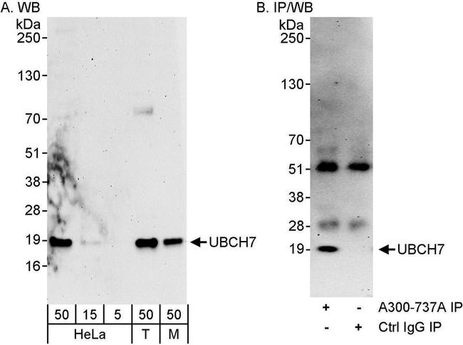 UBCH7 Antibody in Western Blot (WB)