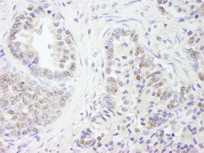 UBE1 Antibody in Immunohistochemistry (IHC)