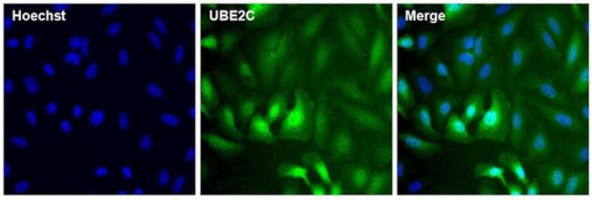 UBE2C Antibody in Immunocytochemistry (ICC/IF)